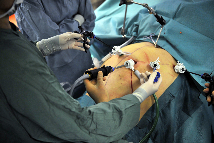 bariatric surgery