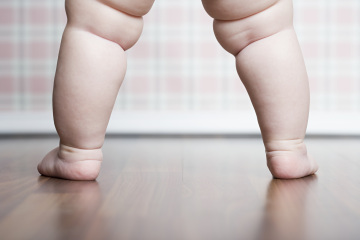 predicting obesity at birth